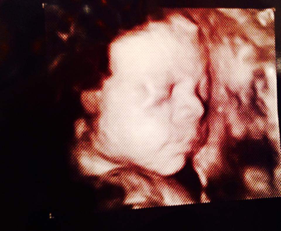 10689628_10152352569456625_8304174765217156847_n